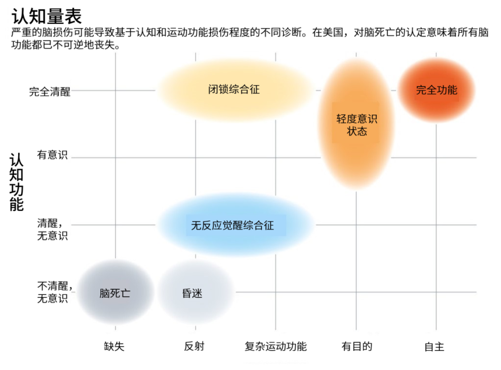 “死亡”到底如何定义？