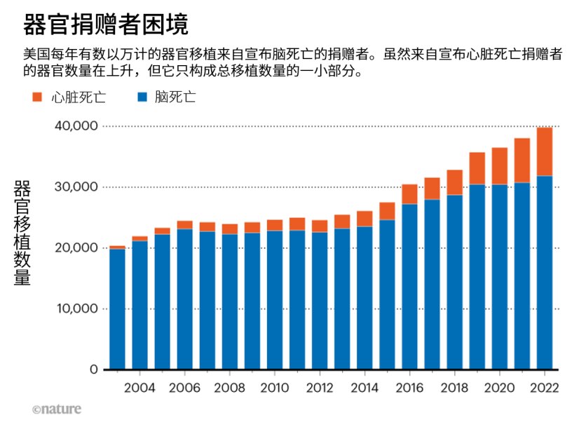 “死亡”到底如何定义？